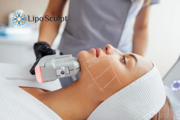 HIFU vs Botulinum Toxin: Understanding the Differences 1 HIFU vs Botox Barry What is the best option for you?