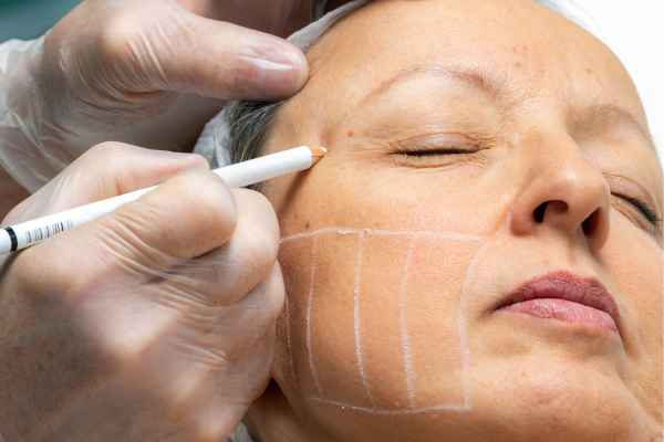 CryoPen: 5 Skin Concerns It May Be Used to Treat 4 What should you ask before having CryoPen treatment Barry?